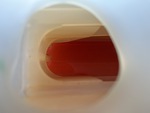 PN600063 - 2023 International LT625: Coolant Reservoir