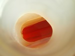 NN034161 - 2022 International LT625: Coolant Reservoir