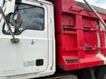 General Appearance with Hand Rails