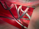 Hydraulics with Hoses